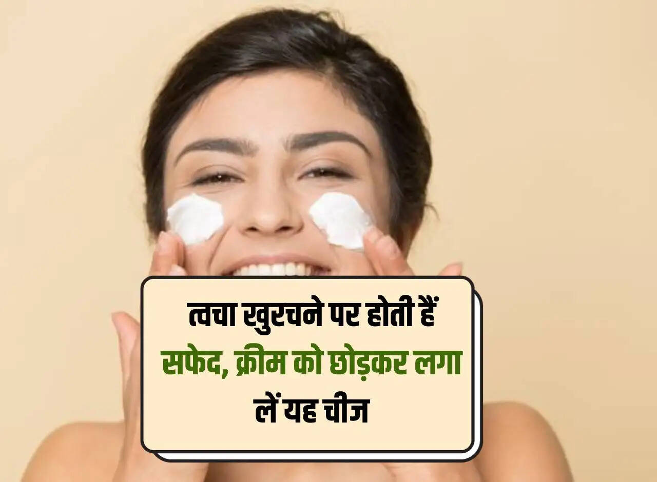 Skin turns white when scratched, apply this thing instead of cream